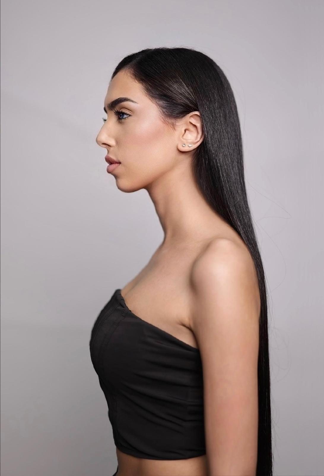 Talent gallery photo